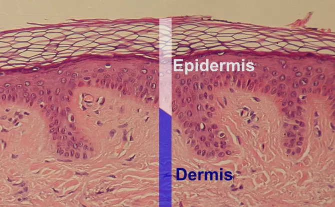 the difference between epidermis pigmentation and dermis pigmentation