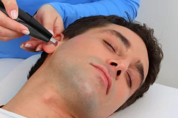 ear hair removal treatment for men