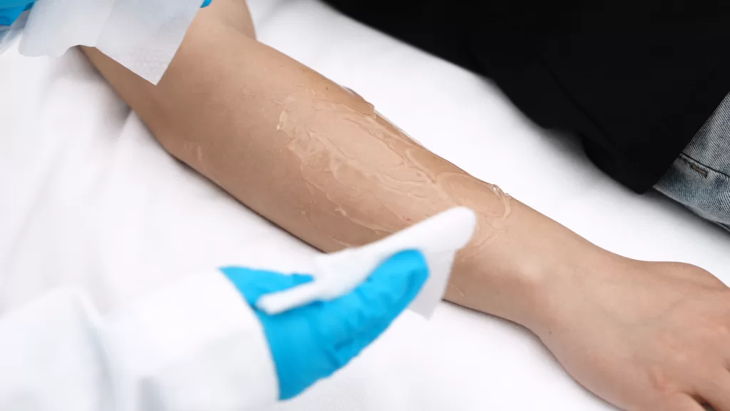 Wipe off the gel and clean the skin