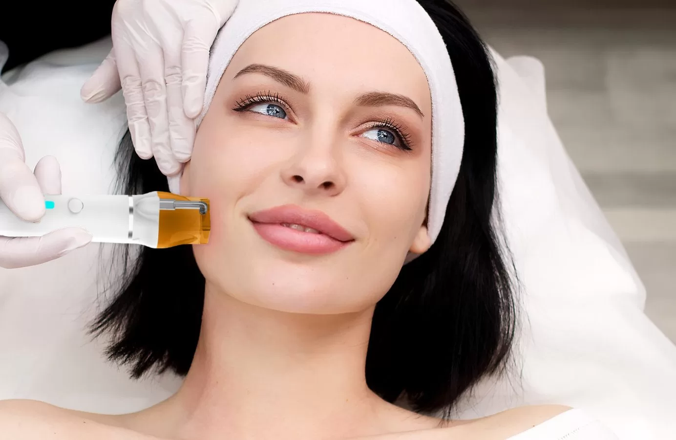 How-Much-Does-RF-Microneedling-Cost