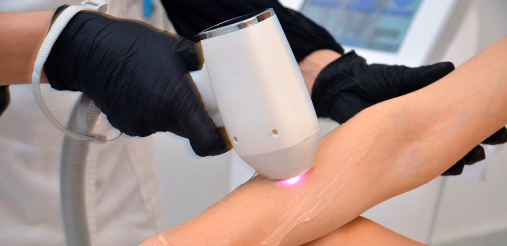 laser hair removal often serves as a gateway treatment