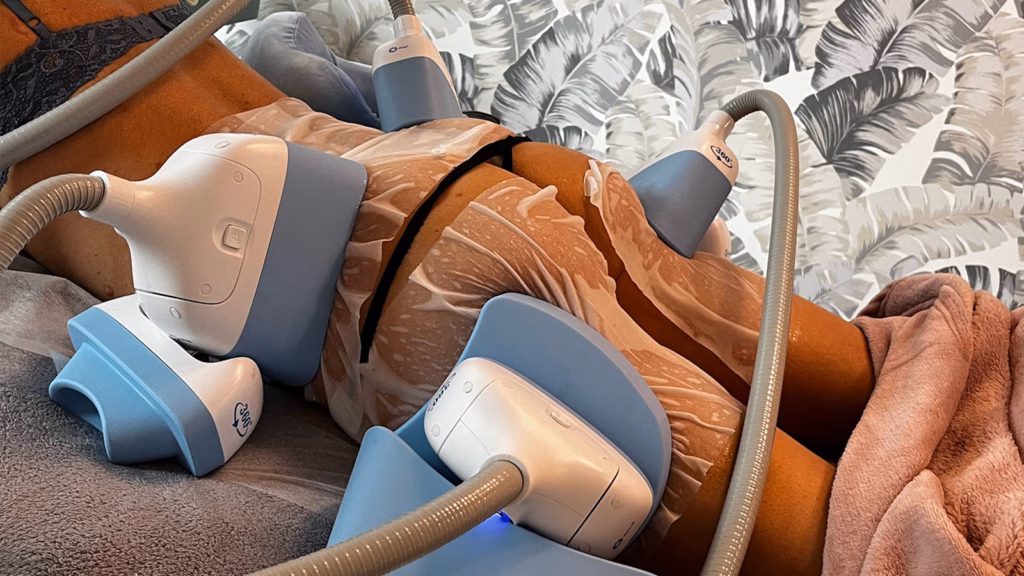 Common Mistakes When Choosing a Fat Freezing Machine