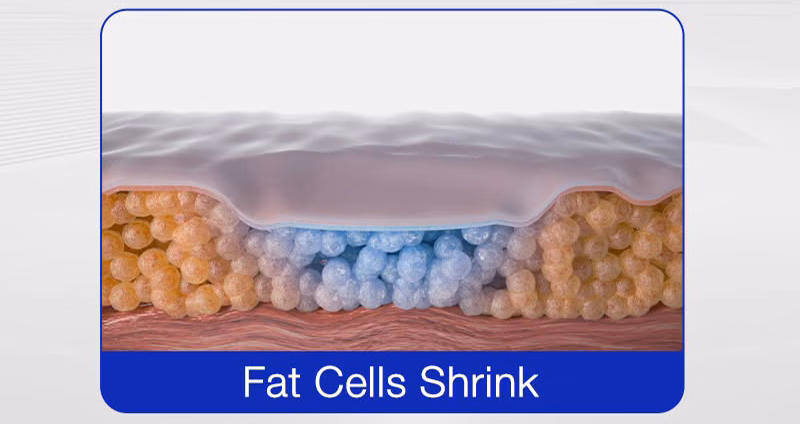 Fat Cell Apoptosis